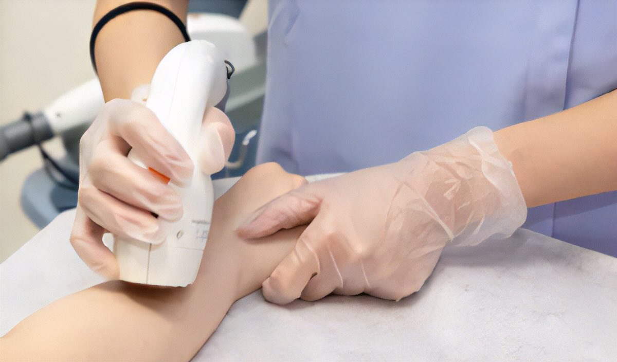 しみ、そばかすの治療に有効なレーザー装置